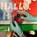 Anatomische Untersuchung eines Herzens mit grünen Handschuhen.