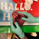 Anatomische Untersuchung eines Herzens mit grünen Handschuhen.